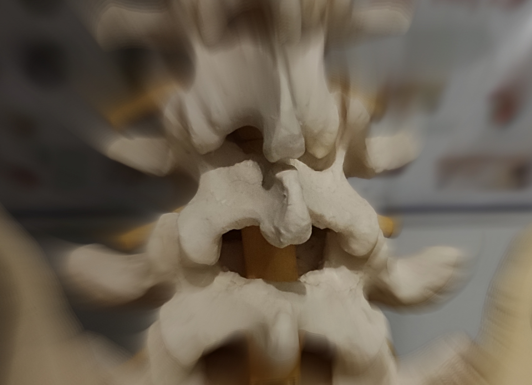 Dorn-Breuss Therapie, Sanfte Wirbelsäulentherapie, Manuelle Therapie bei Rückenschmerzen, Bandscheiben