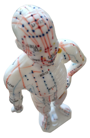 Akupunktur beim Heilpraktiker in der Sportmühle Hilden